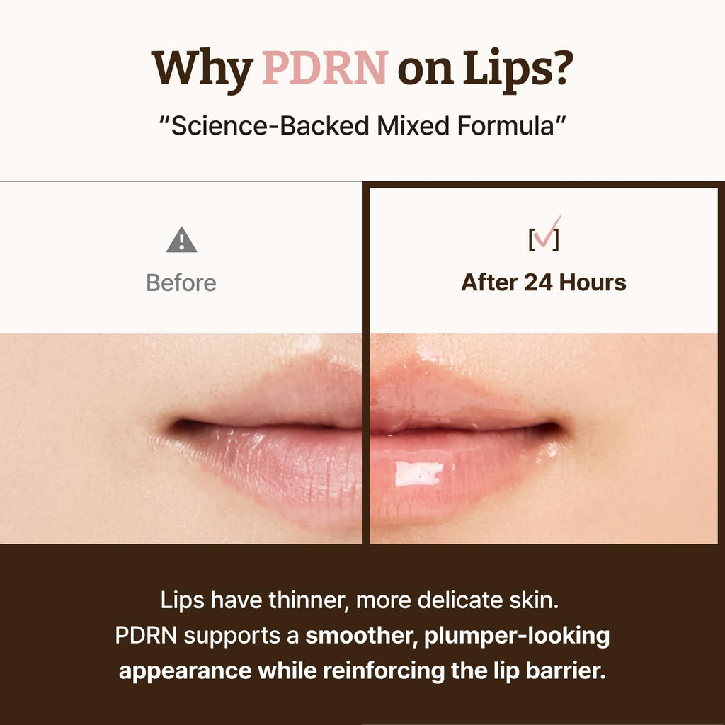 Hydrating PDRN lip treatment for dewy, radiant-looking lips